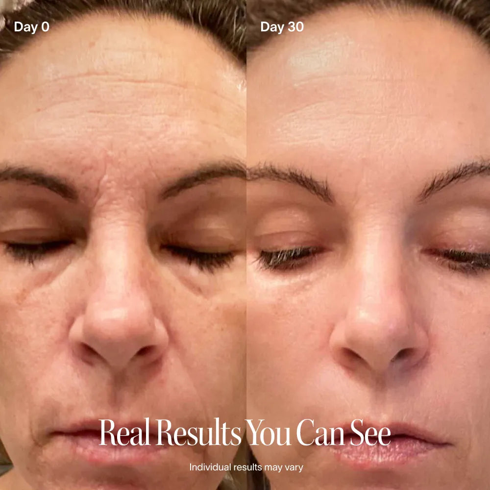 The Wand, 4-in-1 Red Light Therapy Device & Activating Serum Kit